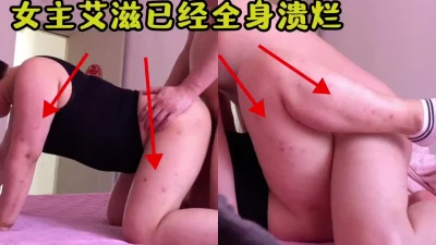 女主艾滋病全身溃烂无套内射